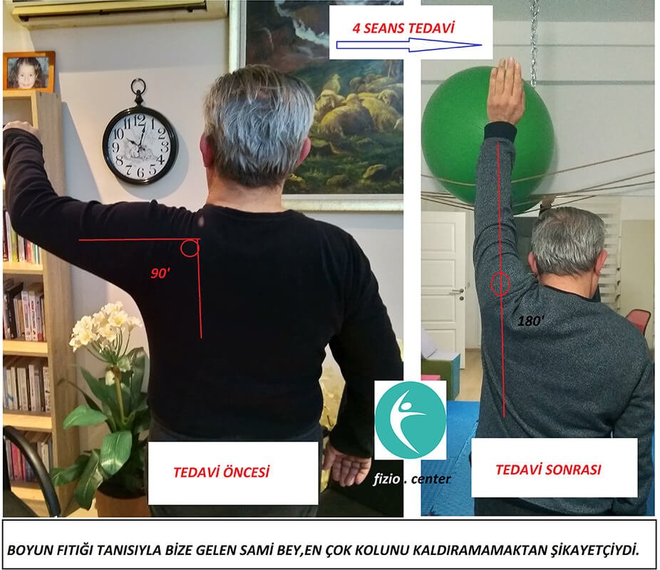 fizio.center Tarık Koban Alanya
